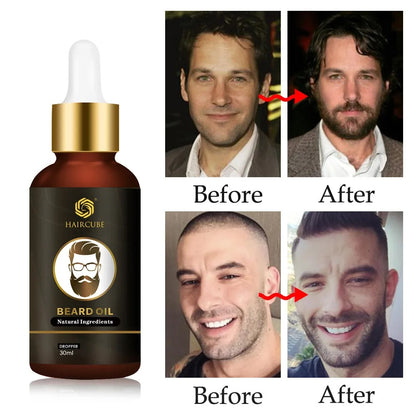 ShopDrop Botanical Beard Growth Oil